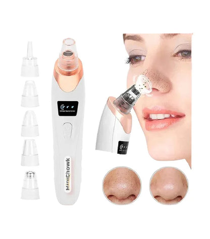 5 in 1 Black Head Remover (original)