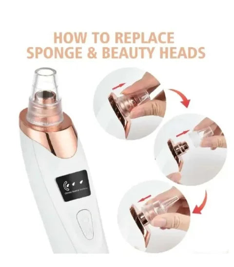 5 in 1 Black Head Remover (original)